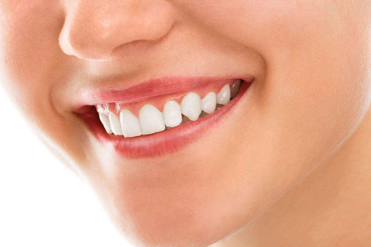 dal-carlo-salute-dentale-sorriso